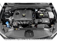 2017 Hyundai Elantra 4Dr Sdn Auto Gls Exterior Shot 3