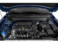 2020 Hyundai Venue Ultimate | 1.6L | Nav | Roof | Blis | Remote Start Exterior Shot 3